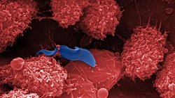 Parazite Saldıran Savunma Hücreleri!