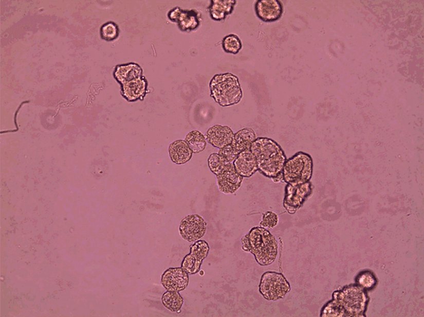 Anthrobotlar spontene bir şekilde birleşerek nöronların (gösterilmemekte) büyümesini destekleyen süperbot adındaki daha büyük yapıyı oluştururlar