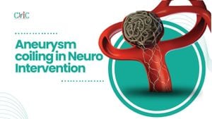 Revolutionary Study Unveils Coiling Techniques For Cerebral Aneurysms