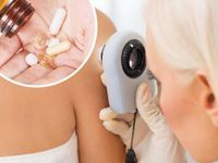 Taking this vitamin may cut your skin cancer risk
