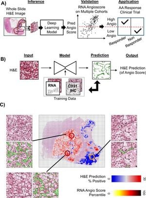 Deep Learning Model Predicts Cancer Treatment Efficacy From Standard Slides