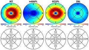 Exploring Retinal Thickness: A Window Into Systemic Health