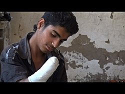 Neden biz insanlar birbirimizi cezalandırmak için uzuvlarımızı keseriz ?