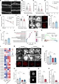 Smoking aggravates neovascular age-related macular degeneration via Sema4D-PlexinB1 axis-mediated activation of pericytes - Nature Communications