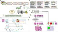 Stroma and lymphocytes identified by deep learning are independent predictors for survival in pancreatic cancer - Scientific Reports