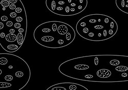 Paralel evrenler görseldeki gibi olabilir mi? Sizin paralel evren görüşünüz nedir?