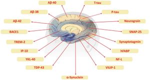 Researchers Reveal Immune System Changes Linked To Alzheimer's Onset