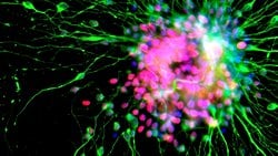 İnsan Derisi Hücreleri Beyin Hücrelerine Dönüştürüldü!