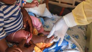 Africa CDC Urges Action Amid Rising Mpox Cases