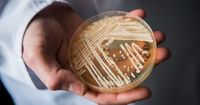 Deadly, drug-resistant fungus spreading at ‘alarming rate,’ CDC warns - National | Globalnews.ca