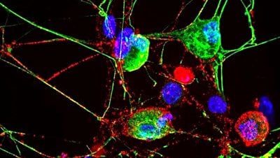 Proteazom Nedir? Nöronal Membran Proteazomlar Nörolojik Sağlığın Korunmasında Nasıl Bir Rol Oynarlar?