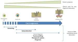 New Insights Into DNA Methylation Of ANGPT1 Gene's Role In Breast Cancer Prognosis