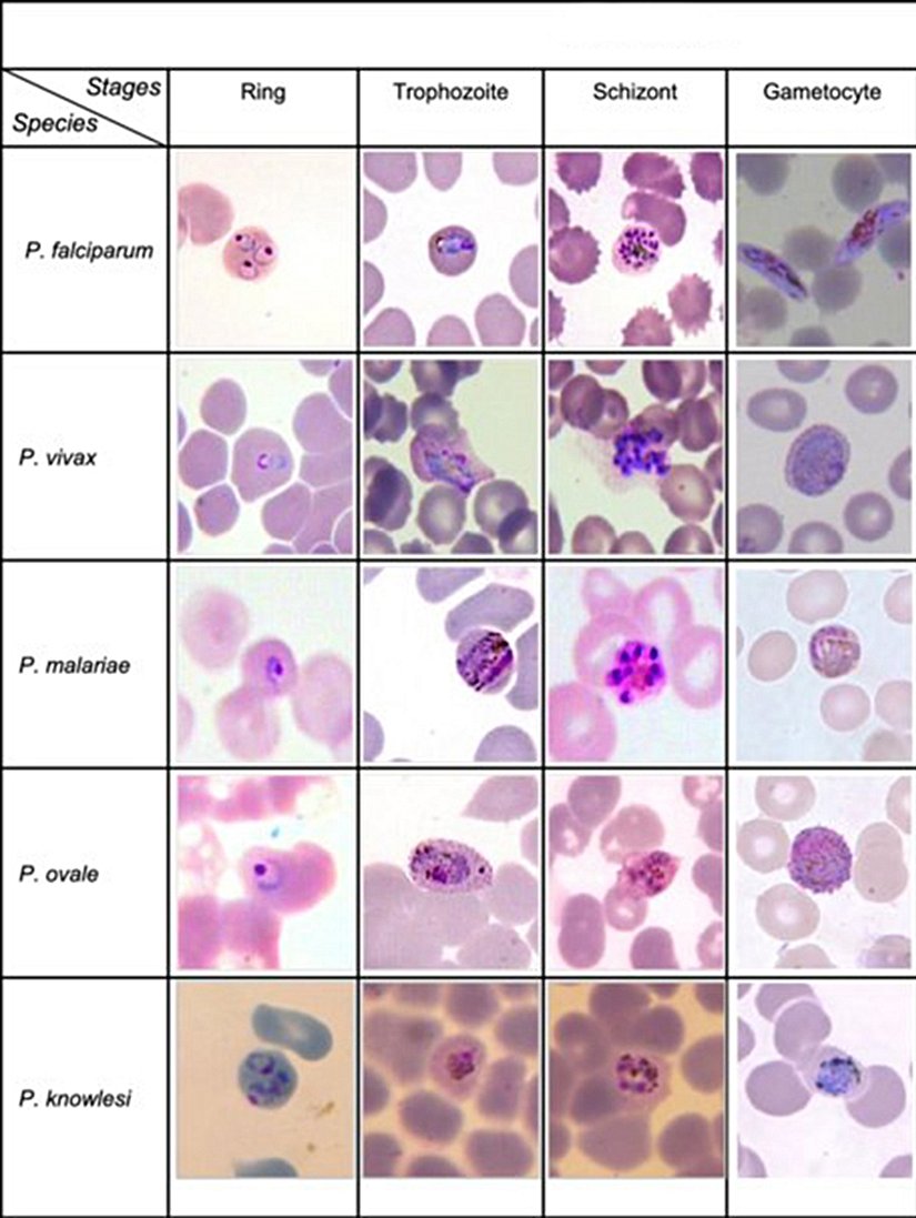 Plasmodium türlerinin yaşam safhalarına göre kan preparatında görünümü