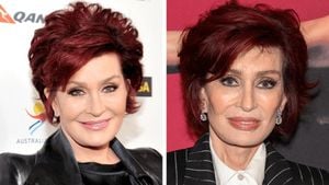 Sharon Osbourne Sparks Surgery Speculation With Dramatic New Look