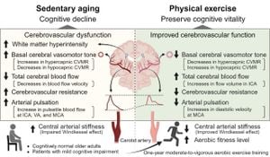 Research Finds Cerebral Blood Flow Loss Linked To Aging Cognitive Decline