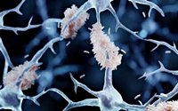 Alzheimer's Breakthrough Demands New Health Policies