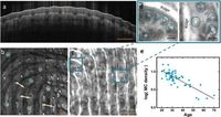 The role of skin hydration, skin deformability, and age in tactile friction and perception of materials - Scientific Reports