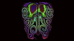 30 Yıllık Ders Kitabı Modeli Yıkıldı: Burun Koku Alıcılarının İlk Ayrıntılı Haritası Çizildi.