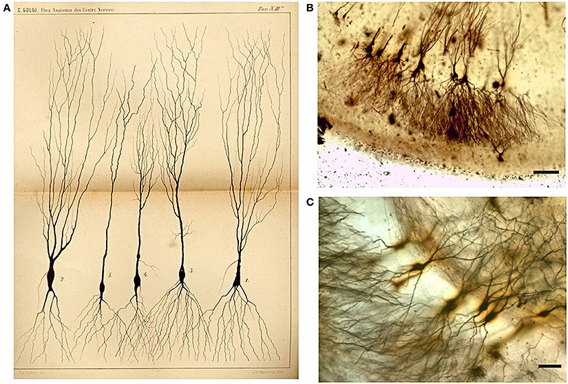 Şekil 2: Çizim (A) ve tavşanın Camillo Golgi emdirilmiş Ammon boynuzundan görüntüler (B,C). (A) Çizim Camillo Golgi'nin (1885) XIII numaralı tabağıdır. "Sinir sürecinin" ilk kısmı (akson) kırmızı ile çizilmiş ve Camillo Golgi açıklama kısmında "bu kısmın bolca dallanan çok sayıda ikincil fibrillere dallanmasının genel bir kural olarak kabul edilmesi gerektiğini" belirtmiştir.