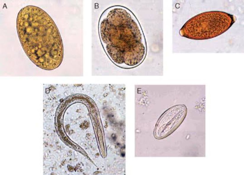 Enterobius vermicularis (Kılkurdu) gelişim evreleri