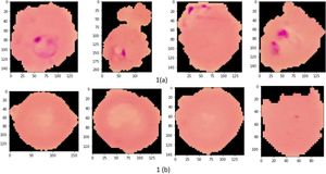 AI-Driven Model Revolutionizes Malaria Parasite Detection Accuracy