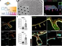Accessible homeostatic gastric organoids reveal secondary cell type-specific host-pathogen interactions in Helicobacter pylori infections - Nature Communications