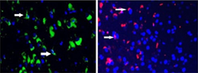 Nörodejeneratif bir hastalığı olan fareler, SDV1a aldıklarında hem terapötik kök hücreleri (kırmızı) hem de toksik hücreler (yeşil) kayboldu. Bu durum daha uzun ömür ve hastalık semptomlarının geciktirilmesine karşılık gelir. Bu sonuçlar, SDV1a'nın kök hücre tedavilerinin etkinliğini artırmak için kullanılabileceğini gösterdi.