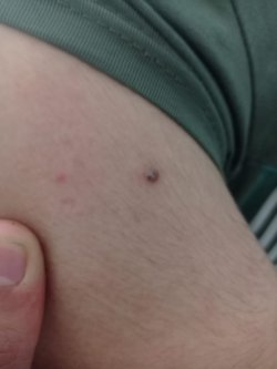 Arkadaşlar bunun hakkında bildiğiniz birşey varmı? Korkmamı gerektirecek bişey varmı?