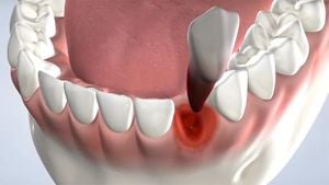 New Study Shows L-PRF Boosts Healing For Tooth Surgery