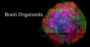 Magnetically Reshapable 3D Electrode Arrays Transform Brain Organoid Analysis