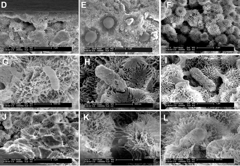 Gómez ve ekibinin Danakil Çöküntüsü’nden aldıkları örneklerdeki mikroorganizmaların Taramalı Elektron Mikroskobu (SEM) görüntüleri
