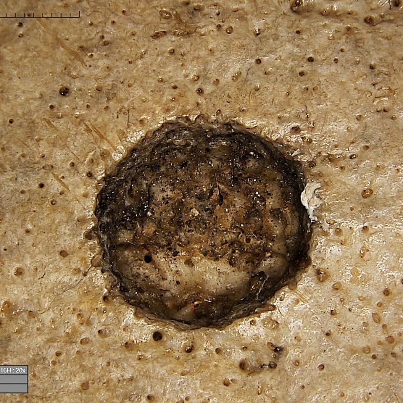 Antik Mısırlıların cerrahi işlem uygulayarak beyin kanseri üzerine çalıştığını ileri süren kaşif; eğer kesikler kişi hayattayken yapıldıysa, hastayı tedavi etmeyi bile denemiş olabilirler.