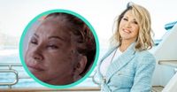 8-Stunden-OP: So viel zahlte Carmen Geiss für ihr neues Gesicht