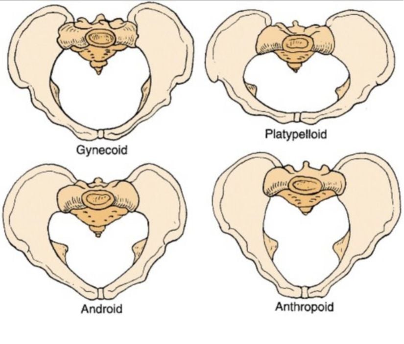 Pelvis tipleri.