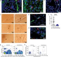 Regulatory T cells in the mouse hypothalamus control immune activation and ameliorate metabolic impairments in high-calorie environments - Nature Communications