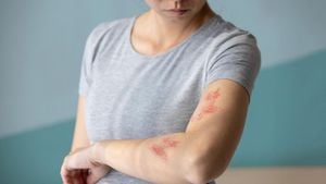 Shingles Outbreak Highlights Urgent Vaccine Need