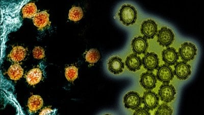 Bu Sonbaharda, COVID-19 ve Grip Karşı Karşıya Geldiğinde Ne Olacak?