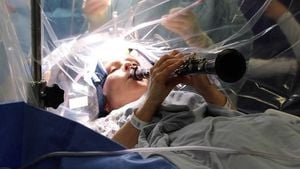 Parkinson’s Patient Plays Clarinet During Brain Surgery