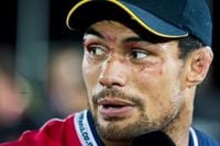 Rugby player Shane Christie, who called for study of concussion, dies at age 39