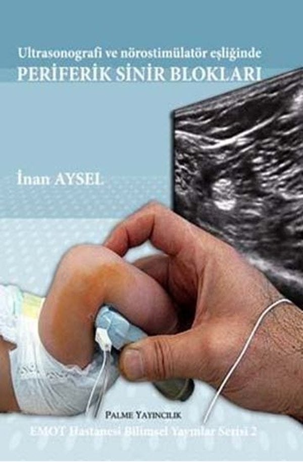 Ultrasonografi ve Nörostimülatör Eşliğinde Periferik Sinir Blokları