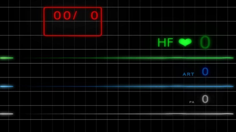 Beyin ölümü gerçekleşmiş hastalar yoğun bakım koşullarında mekanik ventilatöre (solunum destek cihazı) bağlanarak solunumun ve kan dolaşımının devamı sağlanır ve böylece organların oksijen alımı devam eder.