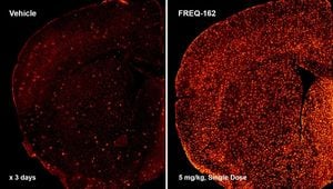 Understanding FKBP5’s Role In Cochlear Function And Hearing Loss