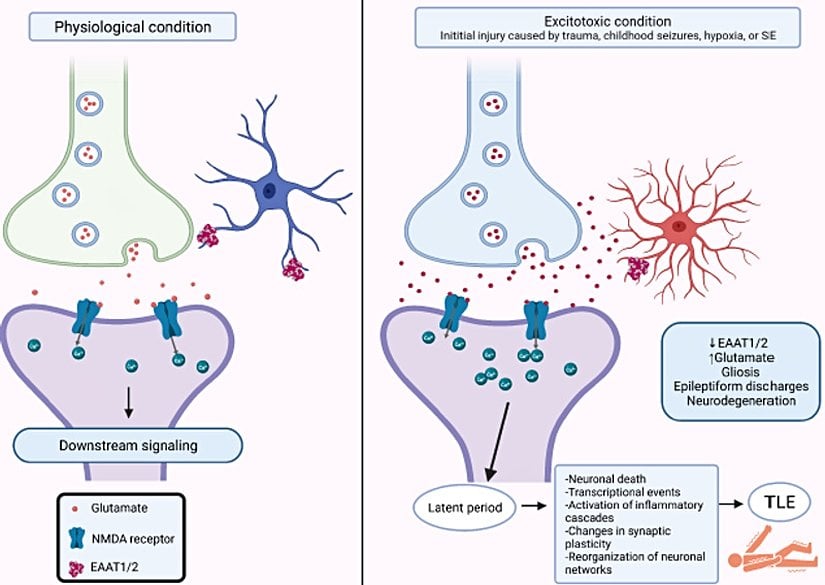 Epilepsi gelişimine yol açan fizyolojik ve eksitotoksisite koşulları altında üç parçalı glutamaterjik sinapsların temsili.