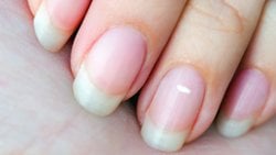 Tırnaklardaki Beyaz Noktalar Gerçekten Vitamin Ve Mineral Eksikliğinden Mi Olur?