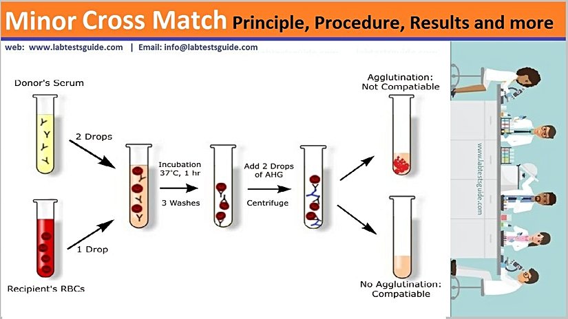 Cross matching (çapraz karşılaştırma)