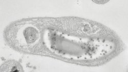 Gölge Enerji: Işık Yemeyen, Karanlığı Seven Bakteriler!