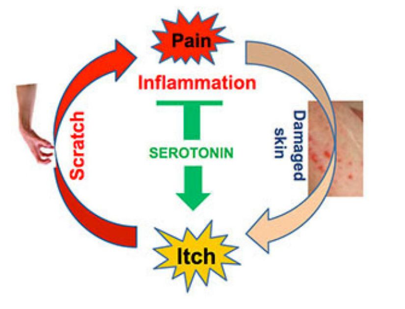 Serotonin tarafından sürdürülen acı-kaşınma döngüsü