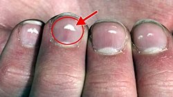 Tırnaklarımızdaki beyazlıklar neden çıkar? Bu beyazlıkları nasıl geçirebilir veya yok edebiliriz?