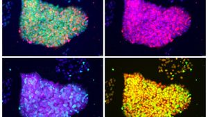 İndüklenmiş Pluripotent Kök Hücreler: Zamanın Geriye Akmasının Biyolojik Yolu!