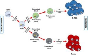 New Research Illuminates Origin Of Preleukemic Cells Linked To Childhood Leukemia